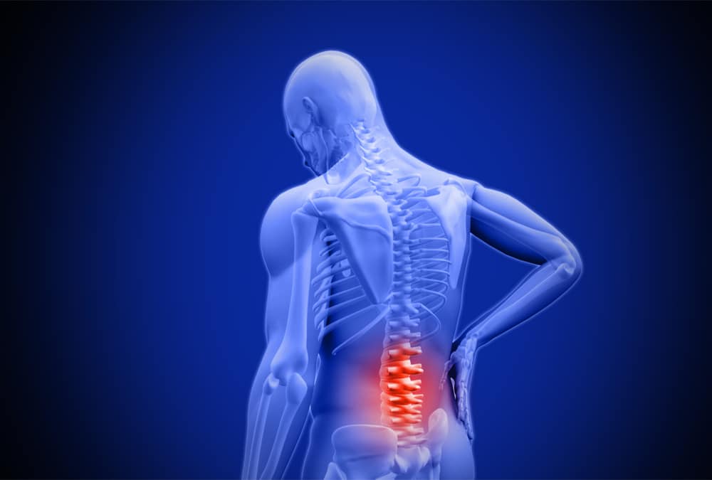 Spinal Stenosis Treatment in Delhi