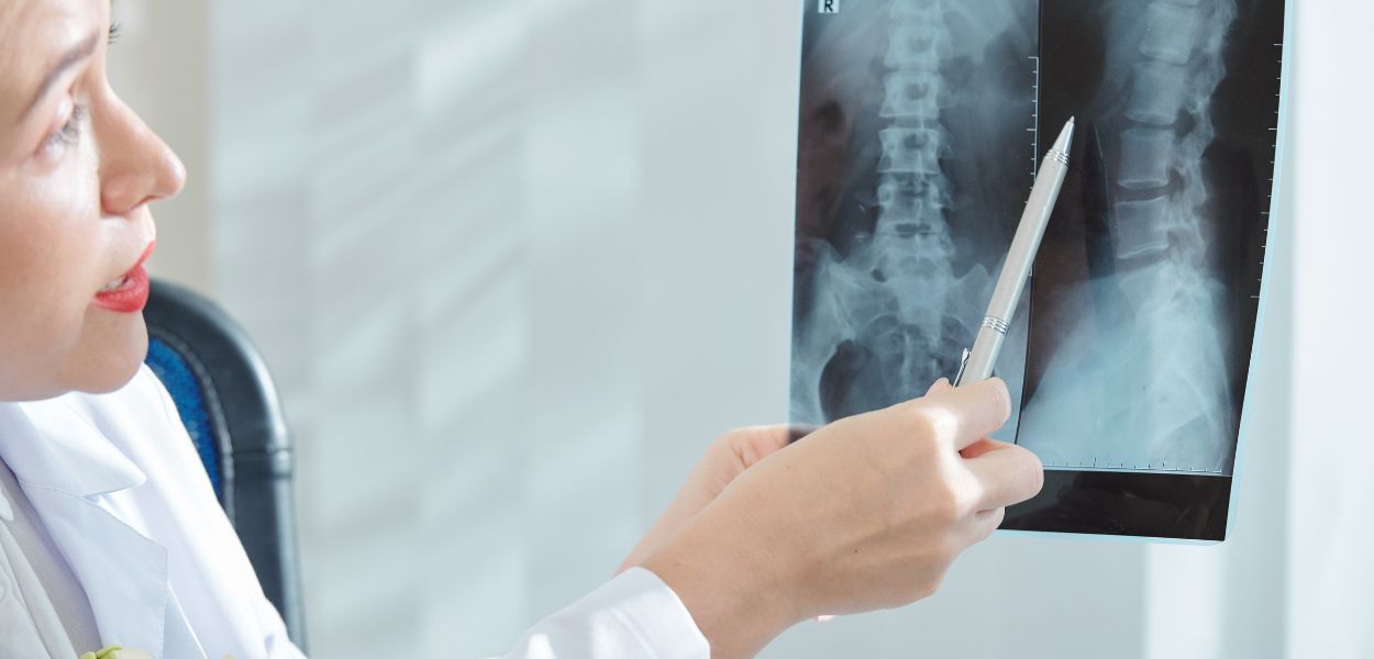 best spine surgeon in delhi ncr