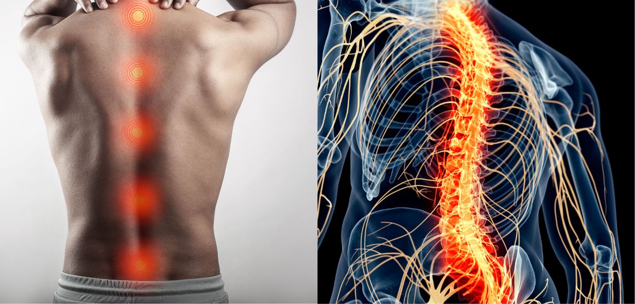 spinal cord specialist in delhi