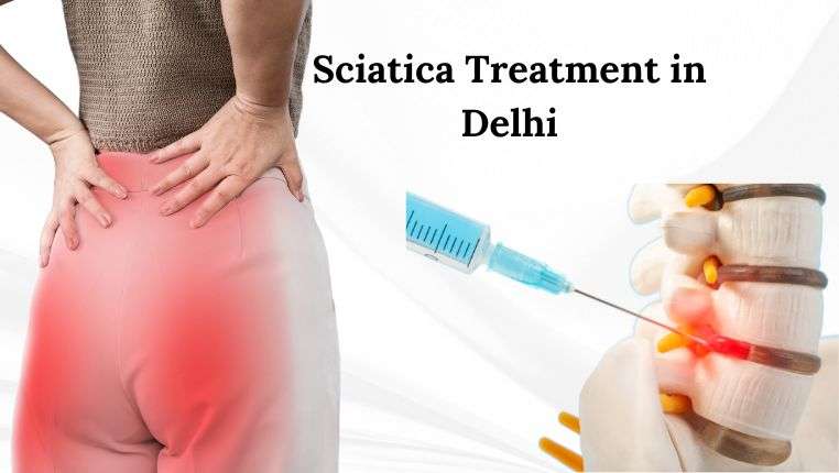 Sciatica Treatment in Delhi